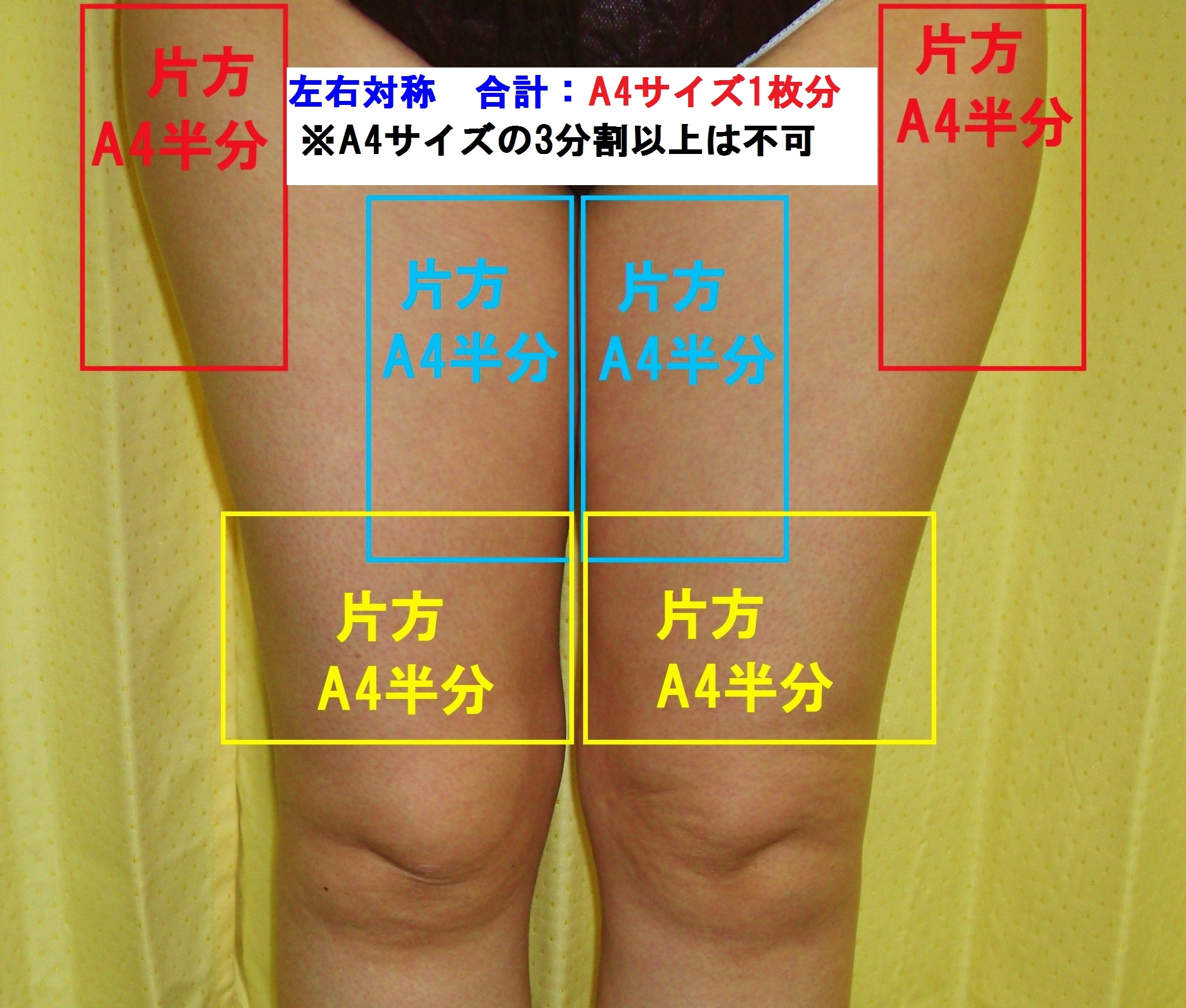 2分割
