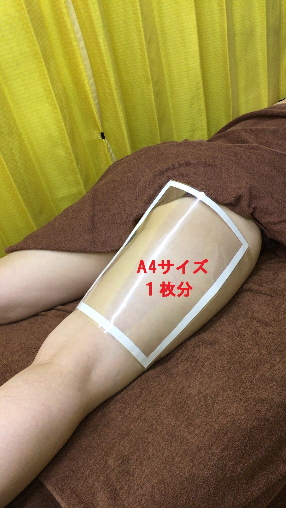 片方1部位