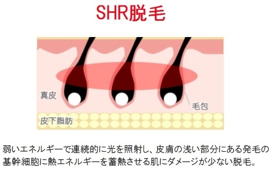 shr