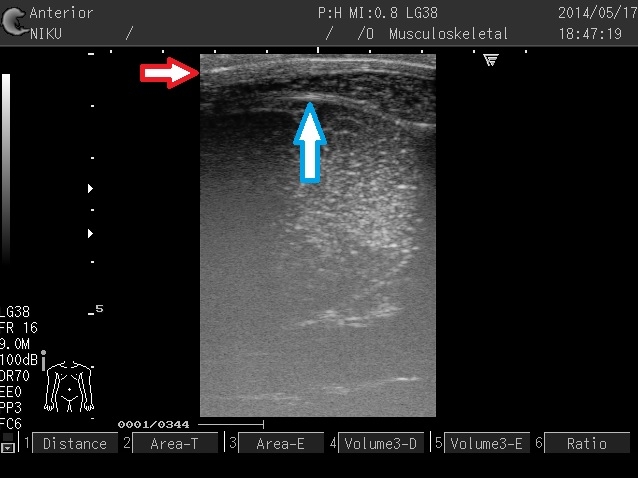 超音波画像診断装置の解析イメージ